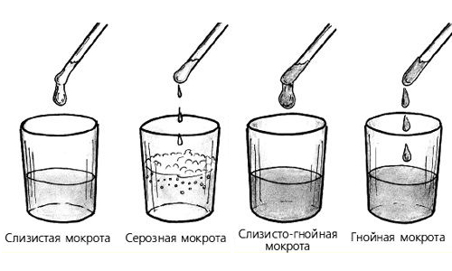 Ребенок откашливает желтую мокроту что это